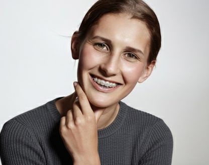 Why More Orthodontists Are Choosing Memotain Bonded Retainers 